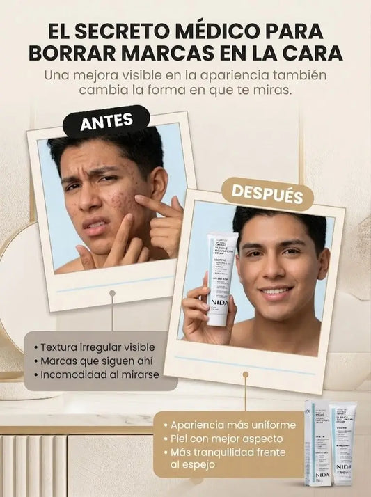 Crema-NIDA