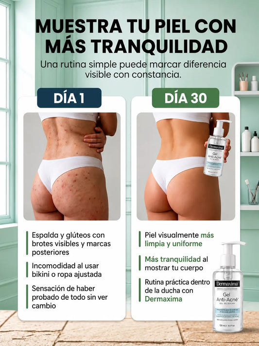 DERMAXIMA GEL DUCHA TIK